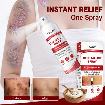 KUBOZN® Beef Tallow Spray for Itchy, Flaky Psoriasis Skin 1