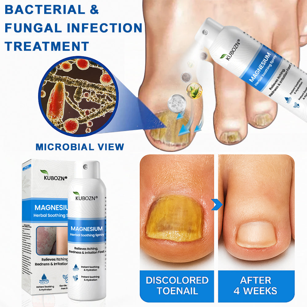 ✅  Official Store: KUBOZN® Magnesium Herbal Psoriasis Spray ⚕️ FDA Certified