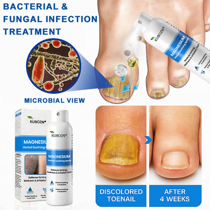 ✅  Official Store: KUBOZN® Magnesium Herbal Psoriasis Spray ⚕️ FDA Certified