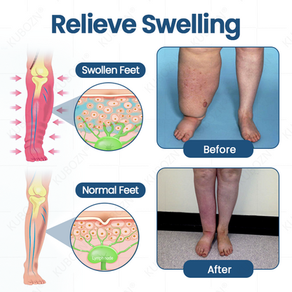 KUBOZN® Roll-On  Cream for Lymphatic Drainage & Swelling Relief