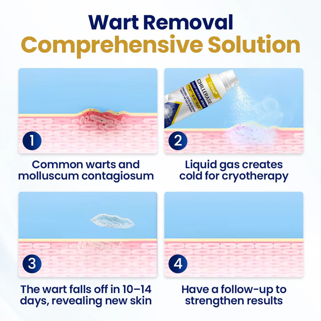 Cvreoz® Professional Cryo-Spray for Warts & Skin Tags - Safe & Effective at Home