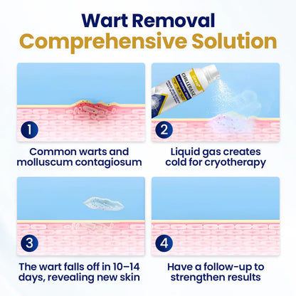 Cvreoz® Professional Cryo-Spray for Warts & Skin Tags - Safe & Effective at Home