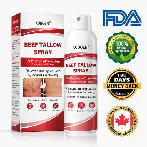 KUBOZN® Beef Tallow Spray for Itchy, Flaky Psoriasis Skin 1