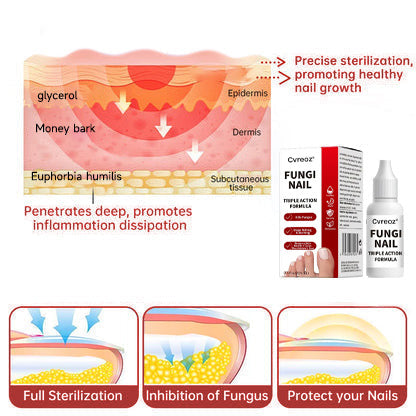 Cvreoz®  Toenail Fungus Treatment | Triple-Action Repair Formula-Plant-Based Formula | MHRA-Registered (ofter)