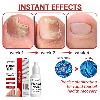 Cvreoz®  Toenail Fungus Treatment | Triple-Action Repair Formula-Plant-Based Formula | MHRA-Registered (ofter)