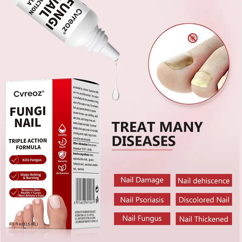 Cvreoz®  Toenail Fungus Treatment | Triple-Action Repair Formula-Plant-Based Formula | MHRA-Registered (ofter)