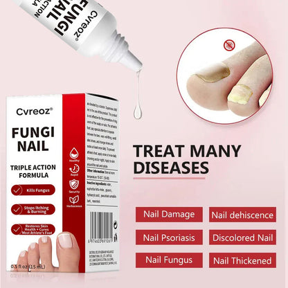 Cvreoz®  Toenail Fungus Treatment | Triple-Action Repair Formula-Plant-Based Formula | MHRA-Registered (ofter)